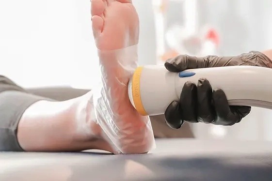 shockwave therapy for feet