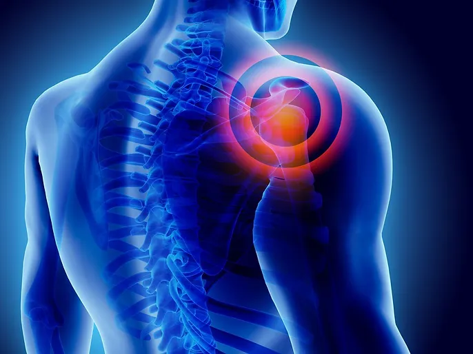 Shoulder pain therapy