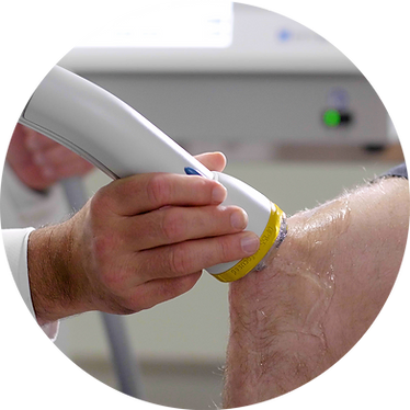 Knee Shockwave Therapy